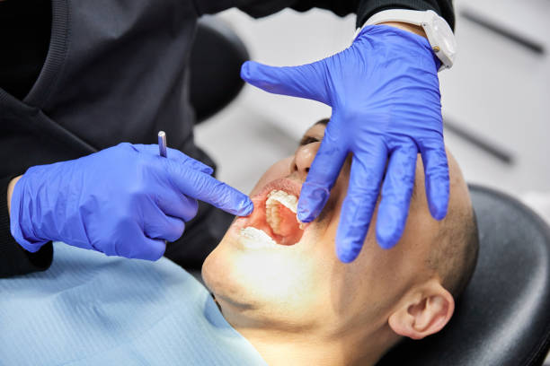 Best Emergency Wisdom Tooth Extraction in Narragansett Pier, RI